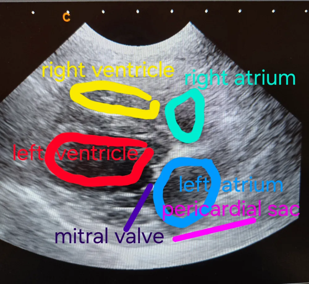 An echocardiogram (cardiac ultrasound) annotated by our vet, labelling the right and left ventricles and atria, the mitral valve and the pericardial sac